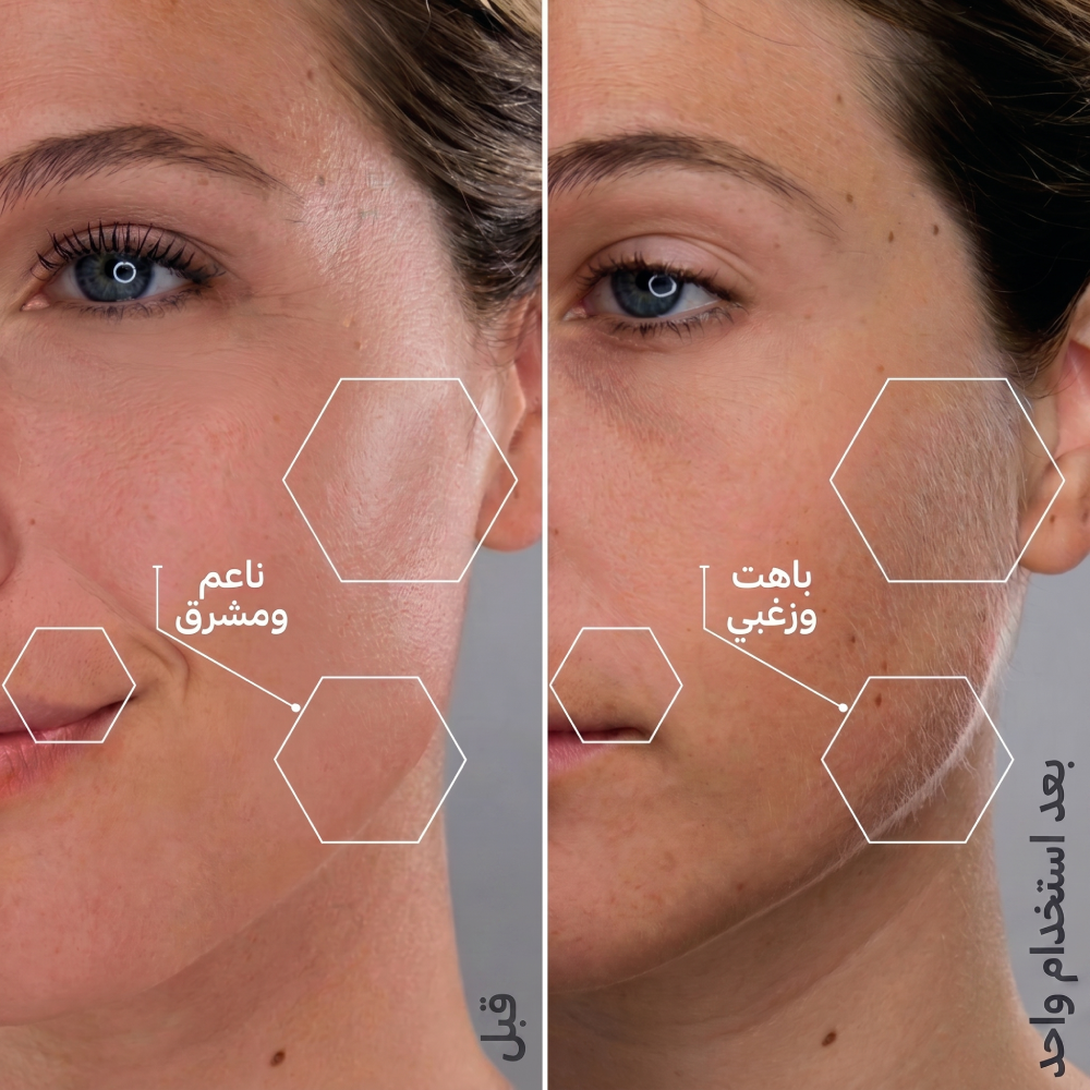 Lavender Side-by-side photos show a woman's skin "dull & fuzzy" before and "smooth & glowy" after using Michael Todd Beauty's سونيك سموث برو+ System for professional exfoliation and sonic dermaplaning.
